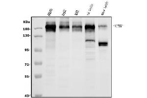 Western blot analysis of VPRBP/DCAF1 using anti-VPRBP/DCAF1 antibody (ABIN7599063). (DDB1 and CUL4-Associated Factor 1 (DCAF1) (AA 1-195) antibody)