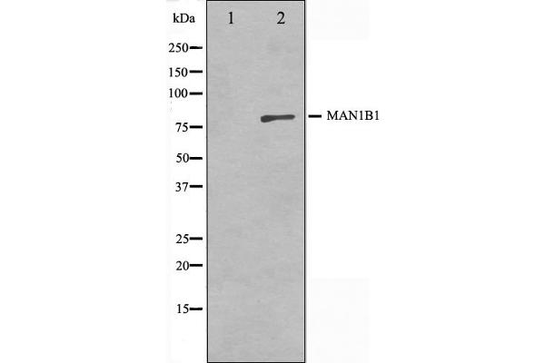 MAN1B1 Antikörper  (Internal Region)