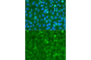 Immunofluorescence analysis of A549 cells using NCK1 antibody. (NCK1 antibody)