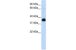 WB Suggested Anti-AIP Antibody Titration: 0. (AIP antibody  (N-Term))