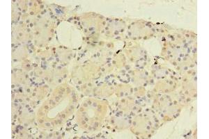Immunohistochemistry of paraffin-embedded human pancreatic tissue using ABIN7148768 at dilution of 1:100 (CWF19L1 antibody  (AA 101-330))