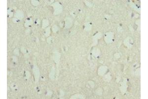 Immunohistochemistry of paraffin-embedded human brain tissue using ABIN7157650 at dilution of 1:100 (KIF3A antibody  (AA 430-699))