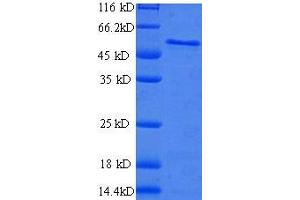 BCAP31 Protein (AA 2-243, partial) (GST tag)