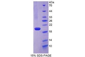 SDS-PAGE (SDS) image for Fibulin 5 (FBLN5) (AA 99-205) protein (His tag) (ABIN2124833)