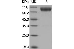 Western Blotting (WB) image for CD200 Receptor 1 (CD200R1) (Active) protein (His tag,Fc Tag) (ABIN7320365) (CD200R1 Protein (His tag,Fc Tag))