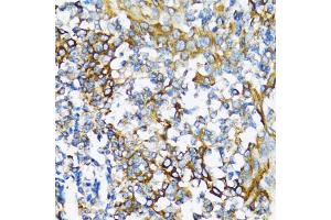 Immunohistochemistry of paraffin-embedded human tonsil using NFKB1 antibody (ABIN6292205) at dilution of 1:100 (40x lens). (NFKB1 antibody)