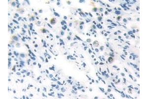 Immunohistochemistry (IHC) image for anti-Docking Protein 3 (DOK3) (AA 128-385) antibody (ABIN7443533)