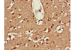 Immunohistochemistry of paraffin-embedded human brain tissue using ABIN7164586 at dilution of 1:100