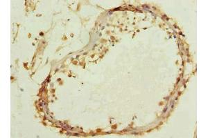 Immunohistochemistry of paraffin-embedded human testis tissue using ABIN7171911 at dilution of 1:100 (TTC16 antibody  (AA 551-873))