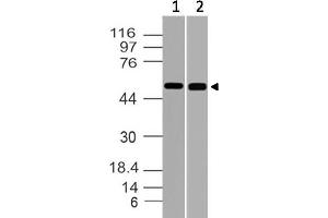 Image no. 1 for anti-RuvB-Like 1 (E. Coli) (RUVBL1) (AA 220-455) antibody (ABIN5027515) (RUVBL1 antibody  (AA 220-455))