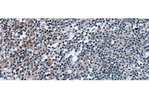 Immunohistochemistry of paraffin-embedded Human tonsil tissue using UGT8 Polyclonal Antibody at dilution of 1:55(x200) (UGT8 antibody)