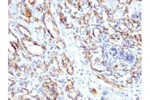 Immunohistochemistry (IHC) image for anti-Platelet/endothelial Cell Adhesion Molecule (PECAM1) antibody (ABIN6940292)