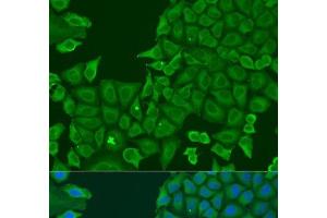 Immunofluorescence analysis of U2OS cells using ABCF2 Polyclonal Antibody at dilution of 1:100. (ABCF2 antibody)