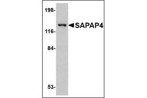 Western blot analysis of SAPAP4 in SK-N-SH cell lysate with this product at 1 μg/ml. (DLGAP4 antibody  (Center))