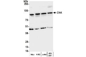 Western Blotting (WB) image for anti-Mitogen-Activated Protein Kinase Kinase Kinase MLT (ZAK) (AA 700-750) antibody (ABIN7452176)