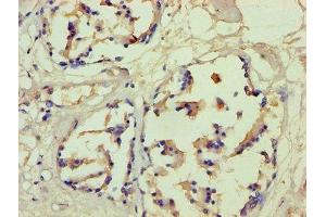Immunohistochemistry of paraffin-embedded human prostate tissue using ABIN7152936 at dilution of 1:100 (Filaggrin antibody  (AA 3838-4061))