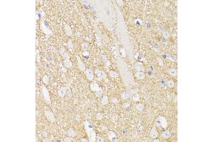 Immunohistochemistry of paraffin-embedded mouse brain using Septin 5 antibody (ABIN6128759, ABIN6147556, ABIN6147557 and ABIN6216776) at dilution of 1:100 (40x lens).