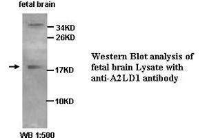 Image no. 1 for anti-gamma-Glutamylamine Cyclotransferase (GGACT) antibody (ABIN1574363) (GGACT antibody)