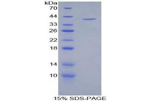 SDS-PAGE (SDS) image for Complement Fragment C4a (C4a) (AA 680-756) protein (His tag,GST tag) (ABIN1880035)