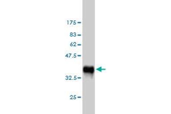 Phospholipase C gamma 1 antibody  (AA 1192-1291)