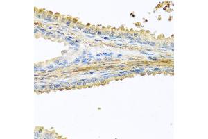 Immunohistochemistry of paraffin-embedded human prostate using PIP antibody (ABIN5973796) at dilution of 1/100 (40x lens).