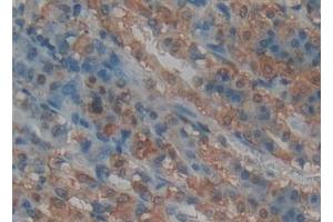 Immunohistochemistry (IHC) image for anti-Tumor Necrosis Factor Receptor Superfamily, Member 11a, NFKB Activator (TNFRSF11A) (AA 31-214) antibody (ABIN7434632)