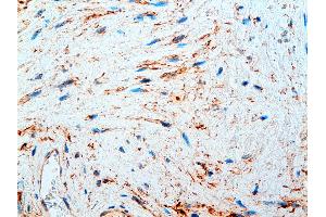 Immunohistochemistry (IHC) image for anti-Plasma Fibronectin antibody (ABIN108418) (Plasma Fibronectin antibody)