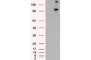 Western Blotting (WB) image for anti-Tuberous Sclerosis 1 (TSC1) antibody (ABIN5868148) (TSC1 antibody)