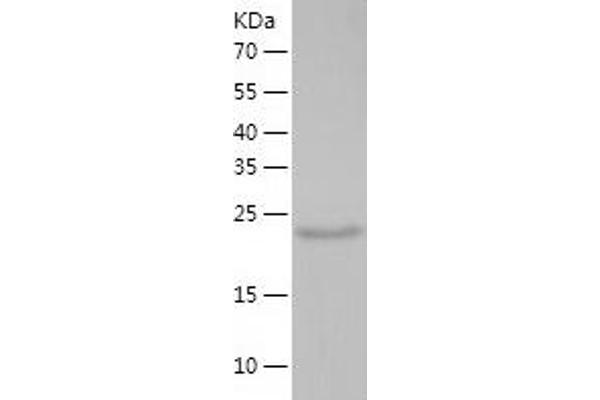KCTD5 Protein (AA 1-234) (His tag)