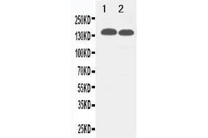 Anti-TJP2 antibody, Western blotting Lane 1: 293T Cell Lysate Lane 2: MCF-7 Cell Lysate (TJP2 antibody  (C-Term))