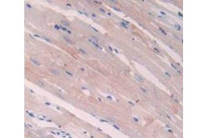 Used in DAB staining on fromalin fixed paraffin- embedded Kidney tissue (NPPA antibody  (AA 25-152))