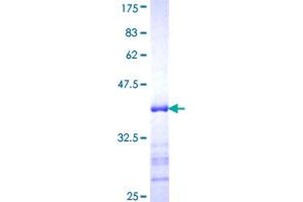 BRCA2 Protein (AA 3319-3418) (GST tag)