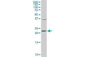 PCMT1 monoclonal antibody (M02), clone 1D6. (PCMT1 antibody  (AA 117-225))