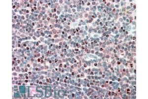 ABIN571002 (5µg/ml) staining of paraffin embedded Human Tonsil. (PSMB10 antibody  (Internal Region))