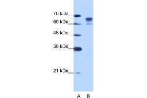WB Suggested Anti-DDX17 Antibody Titration:  1. (DDX17 antibody  (N-Term))