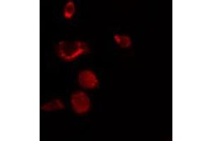 ABIN6272411 staining NIH-3T3 by IF/ICC. (RBM34 antibody  (C-Term))