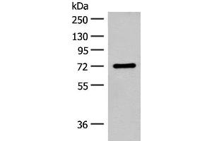 Western blot analysis of Rat brain tissue lysate using SLC6A11 Polyclonal Antibody at dilution of 1:500 (SLC6A11 antibody)