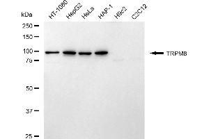Western blotting analysis using TRPM8 antibody (ABIN7800609).