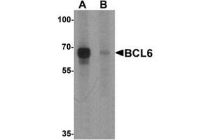 Western blot analysis of BCL6 in rat lung tissue lysate with Bcl6 Antibody  at 1 μg/ml in (A) the absence and (B) the presence of blocking peptide (BCL6 antibody  (Middle Region))