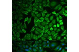 Immunofluorescence analysis of MCF-7 cells using FBXO11 Polyclonal Antibody (FBXO11 antibody)