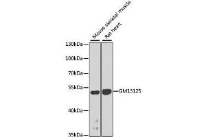 Western blot analysis of extracts of various cell lines, using Gm13125 antibody.