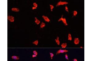 Immunofluorescence analysis of HeLa cells using ATP6V1B2 Polyclonal Antibody at dilution of 1:100. (ATP6V1B2 antibody)