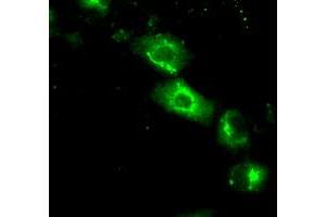 Image no. 3 for anti-Nucleotide Exchange Factor SIL1 (SIL1) antibody (ABIN1496810) (SIL1 antibody)