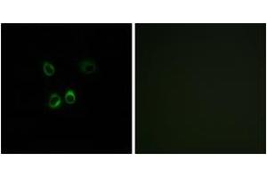 Immunofluorescence analysis of MCF7 cells, using RGR Antibody. (RGR antibody  (AA 169-218))