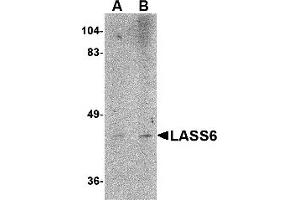 Western Blotting (WB) image for anti-Ceramide Synthase 6 (CERS6) (N-Term) antibody (ABIN1031437) (CERS6 antibody  (N-Term))