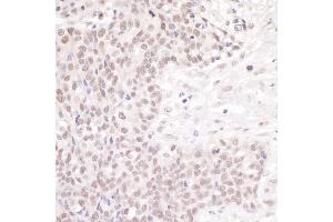 anti-Cleavage Stimulation Factor, 3' Pre-RNA, Subunit 1, 50kDa (CSTF1) (AA 75-125) antibody