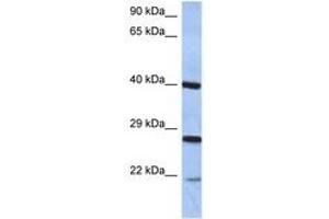 Image no. 1 for anti-Cell Death-Inducing DFFA-Like Effector B (CIDEB) (C-Term) antibody (ABIN6744363) (CIDEB antibody  (C-Term))