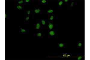 Immunofluorescence of monoclonal antibody to CSE1L on HeLa cell. (Exportin 2 antibody  (AA 872-971))
