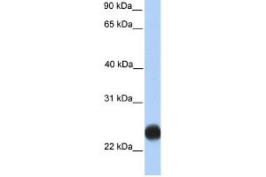 WB Suggested Anti-TMEM123 Antibody Titration:  0. (TMEM123 antibody  (C-Term))
