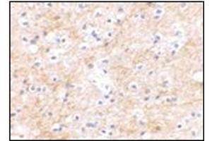 Immunohistochemical staining of human brain tissue using AP30751PU-N at 2. (DLGAP3 antibody  (C-Term))
